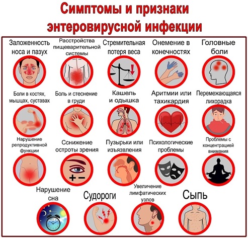 Внимание, энтеровирусная инфекция! Узнай, как не заболеть..